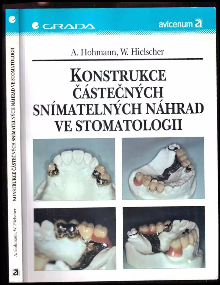 Konstrukce částečných snímatelných náhrad ve stomatologii Andreas